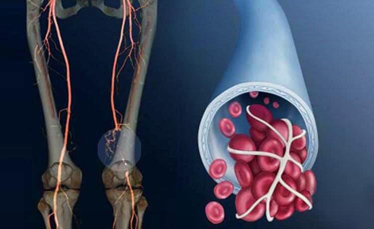 Безоперационое лечение в клинике Harvard medical | http://www.harvardmedical.com.ua/